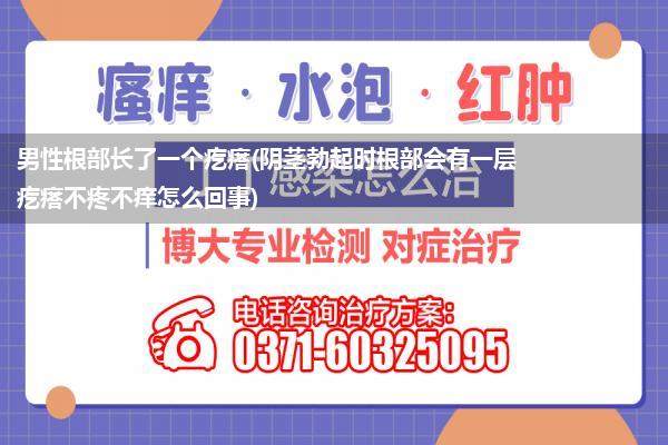 男性根部长了一个疙瘩(阴茎勃起时根部会有一层疙瘩不疼不痒怎么回事)